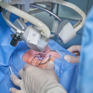 Consultation préopératoire – Avant chirurgie oculaire